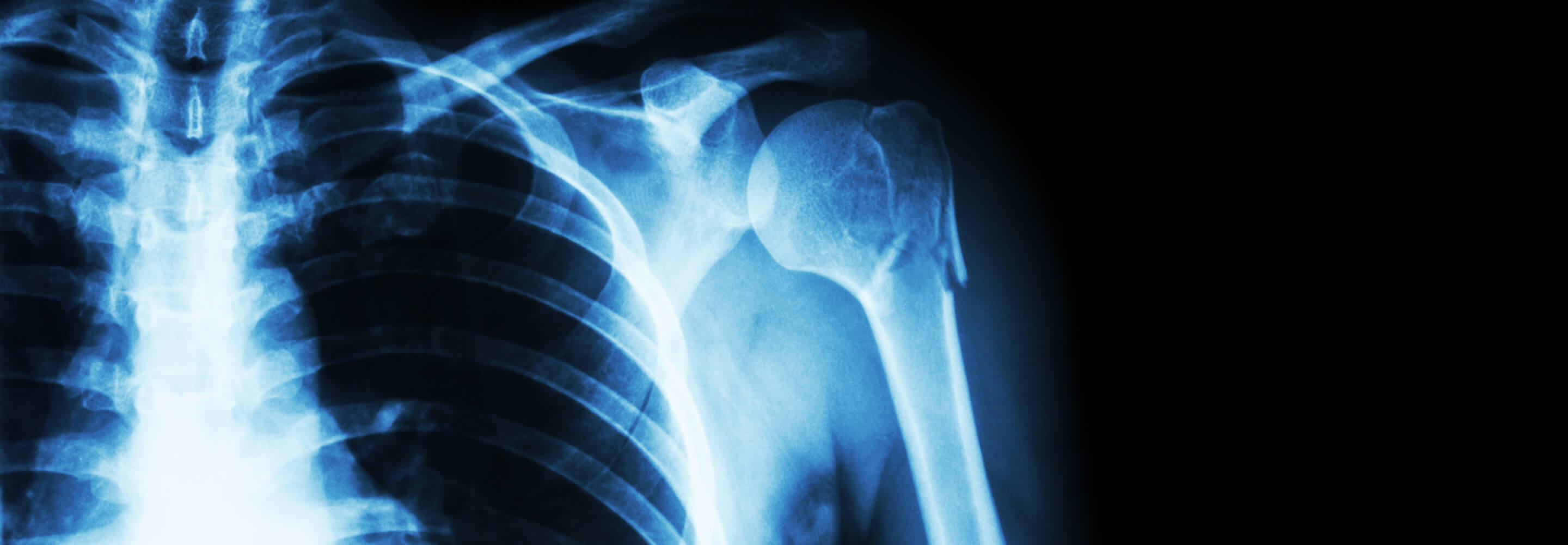 Ralli Ltd: Orthopaedic Claims Banner