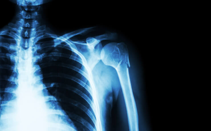Orthopaedic Claims