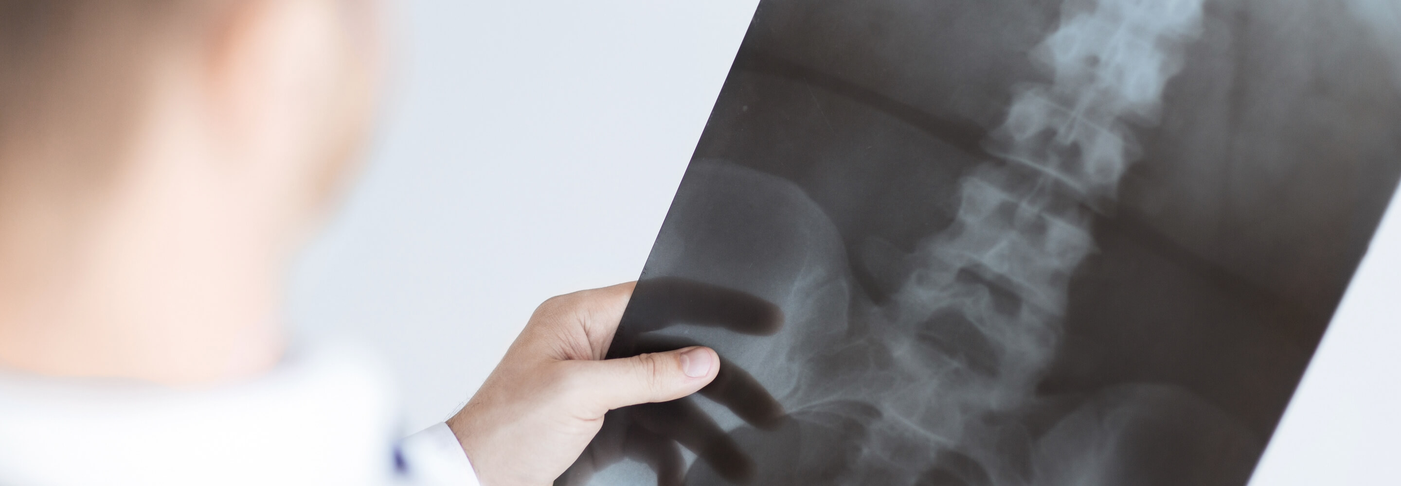 Ralli Ltd: Spinal Injury Claims Banner